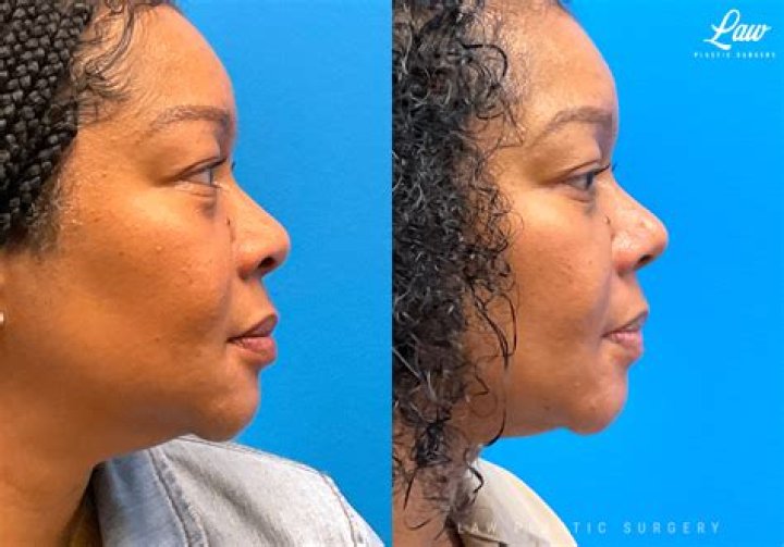A Pioneer In Plastic Surgery