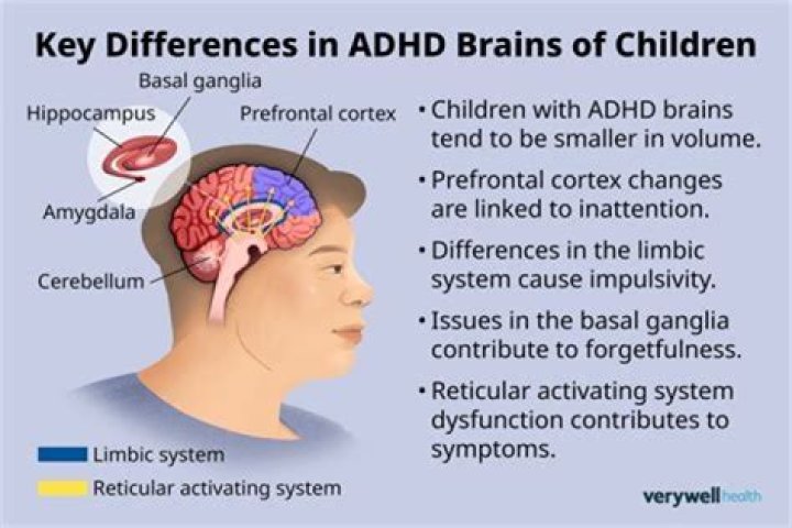Can I Get Drafted If I Have Adhd