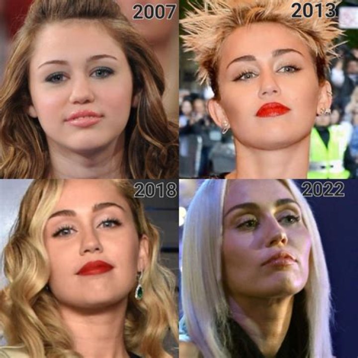 Did Miley Cyrus Get Plastic Surgery