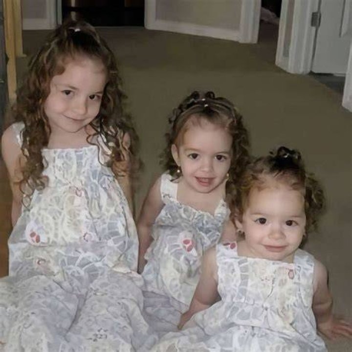 Extreme Sisters Triplets Before Surgery Exposed