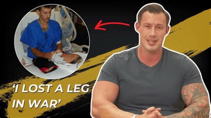 How Did Joey Jones Lose His Legs? |