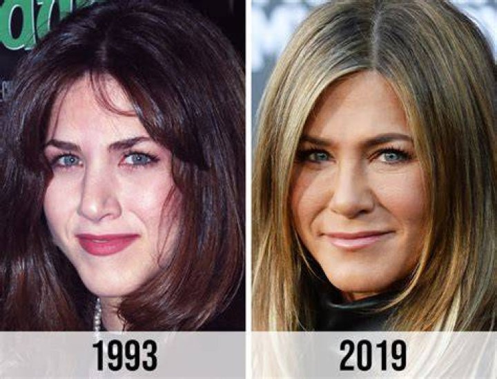 Jennifer Aniston Have Plastic Surgery