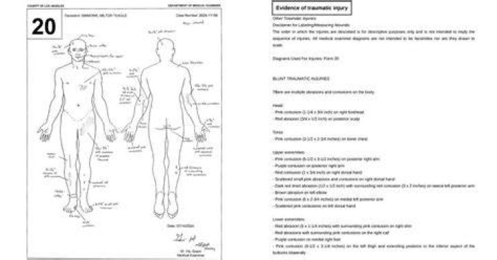 Reagan Hancock Autopsy: Unraveling The Enigmatic End