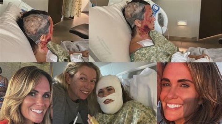 Savannah Grant: The Acid Attack Incident That Shook Lives