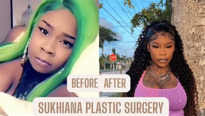 Sukihana Plastic Surgery: Everything You Need to Know