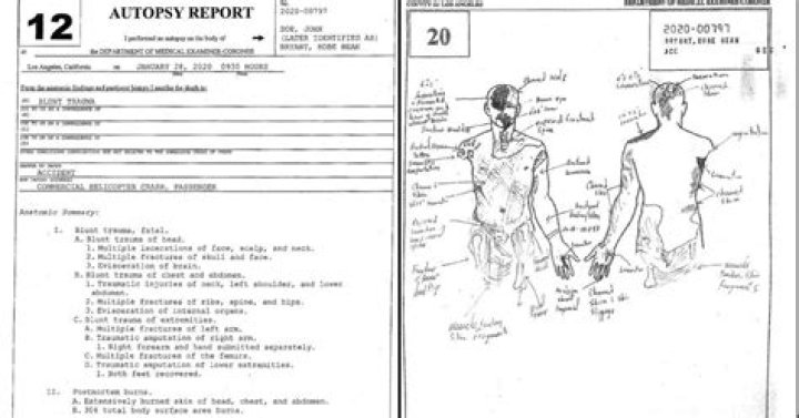 Tragic Details Found In Elliott Smith's Autopsy Report