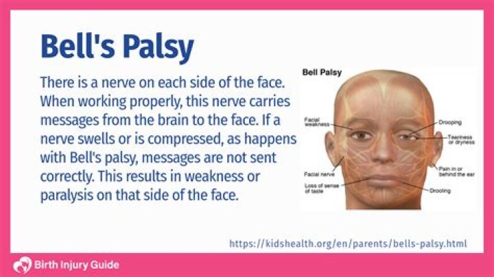 Uncovering Stephanie Ruhle's Bell's Palsy Journey: Insights And Discoveries