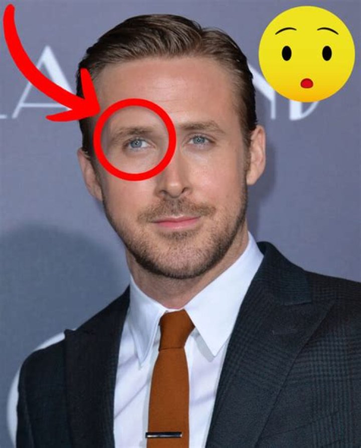 Unveiling The Enigmatic World Of Lazy Eyed Actors: Surprising Revelations And Triumphs