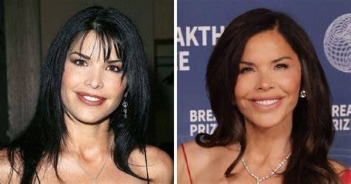 Unveiling The Truths Behind Susan Page's Plastic Surgery Journey: Discoveries And Insights